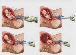 preciso-rir:   Janeiro: Mamãe descobriu que eu era um menino. Fevereiro: Mamãe e papai brigaram. Acho que foi por minha causa, mas fiquei quietinho..Março: Chutei sua barriga. Desculpe mamãe, foi sem querer.Abril : Mamãe e papai brigaram de novo…