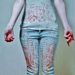  Self Harm is not always obvious. March 1st