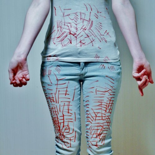  Self Harm is not always obvious. March 1st is self injury awareness day. 