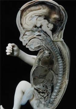  Prossection of a fetus. 