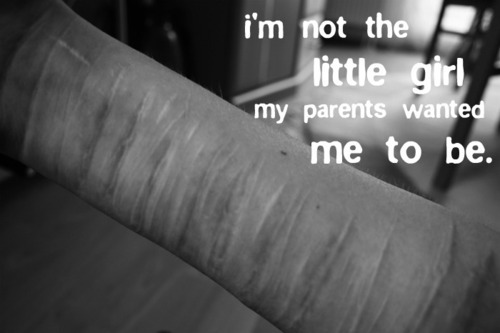 watch-me-bleed:  (via imgTumble) 