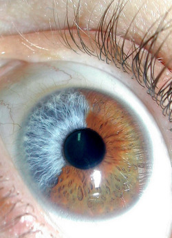 liddlewolfe:  My cousins eyes look like this.