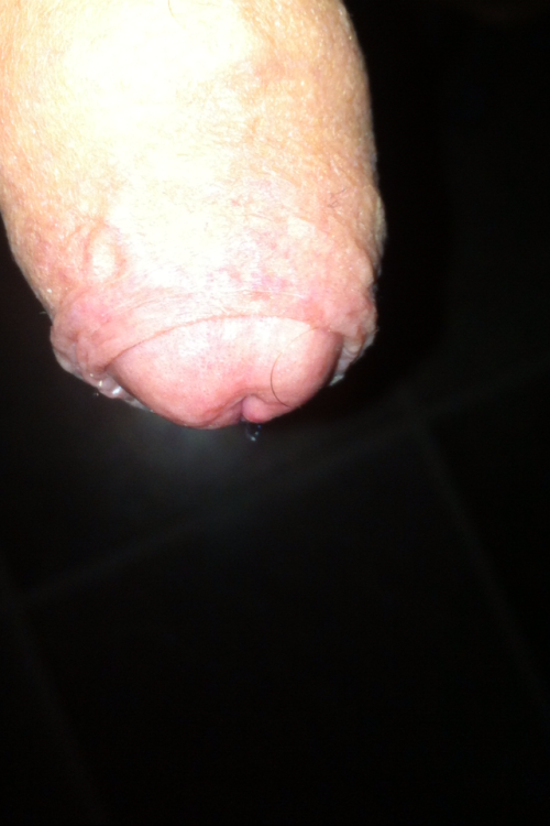 artyfartymasculine:  Foreskin