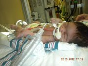 areebax3:  saraxoxo3:  d-a-n-c-i-n-g-w-a-t-e-r-s: PLEASE STOP AND READ THIS      See this baby right here? he’s my cousin Adam, He’s about 3 weeks old and is fighting for his life. He has this rare condition that only 4 babies in the world had