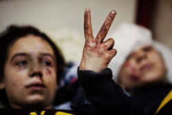 timelightbox:  Rodrigo Abd—AP March 10, 2012. Hana, 12, flashes the victory sign next to her sister Eva, 13, as they recover from severe injuries after the Syrian Army shelled their house in Idlib, north Syria. Their father and two siblings were killed