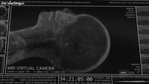 twi-blast:  xwhatserface:  This is a person dying under an MRI scan some doctors don’t know what the fuck they’re doing and shoot their patients tragically beautiful.  How many times am I going to have to point out that this clip is from the Walking