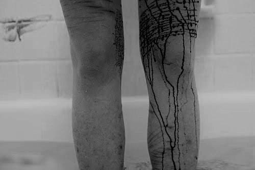 scars