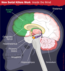 criminalprofiler:  Brain Injury and Serial Murder Some researchers theorize that serial killers have brain damage or other biological abnormalities that contribute to their actions. Damage to areas like the frontal lobe, the hypothalamus and the limbic