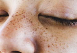 feathere:  dem freckles 