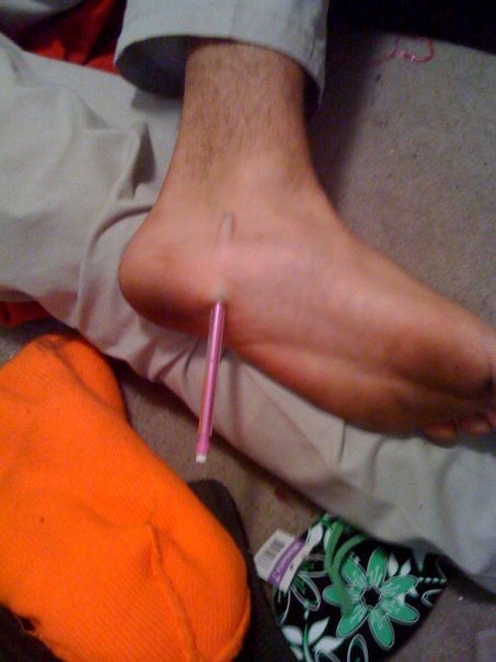 theinturnet:  fuckyeahfullofail:  remember that time I said nothing could hurt worse