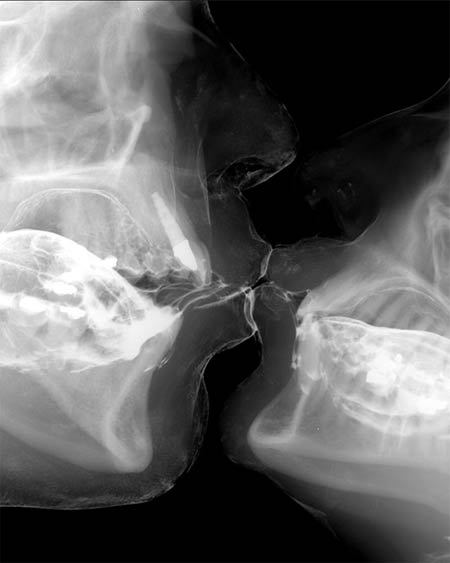 geneticist:  An X-ray of two lovers kissing  (via) 