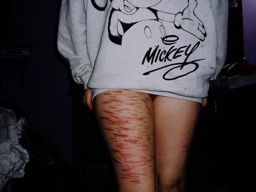 i want to be the car crash