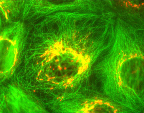 fuckyeahmolecularbiology: Immunofluorescence staining of the Golgi apparatus (in red).