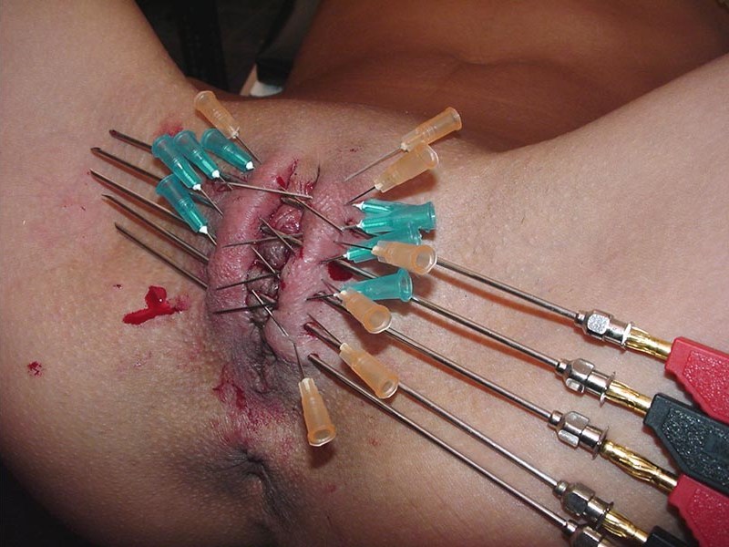 pussymodsgalore  BDSM pain games and needle play. Pussy closed off by multiple needles,
