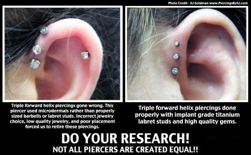 piercingsbyaj:  This is what I had to deal with last night. Poor girl was pierced by somebody at the Philly convention and this “piercer” put 3 surface anchors in her cartilage. As you can see, just about everything is wrong with the piercings on