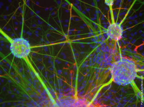 fuckyeahmolecularbiology: Primary rat neurons grown as neurospheres. Image Source: Dr. Rowan Orme, K