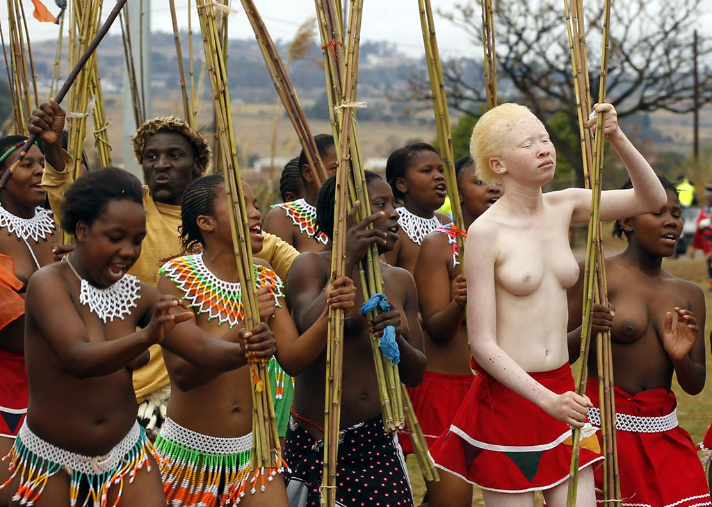 Nude albino women