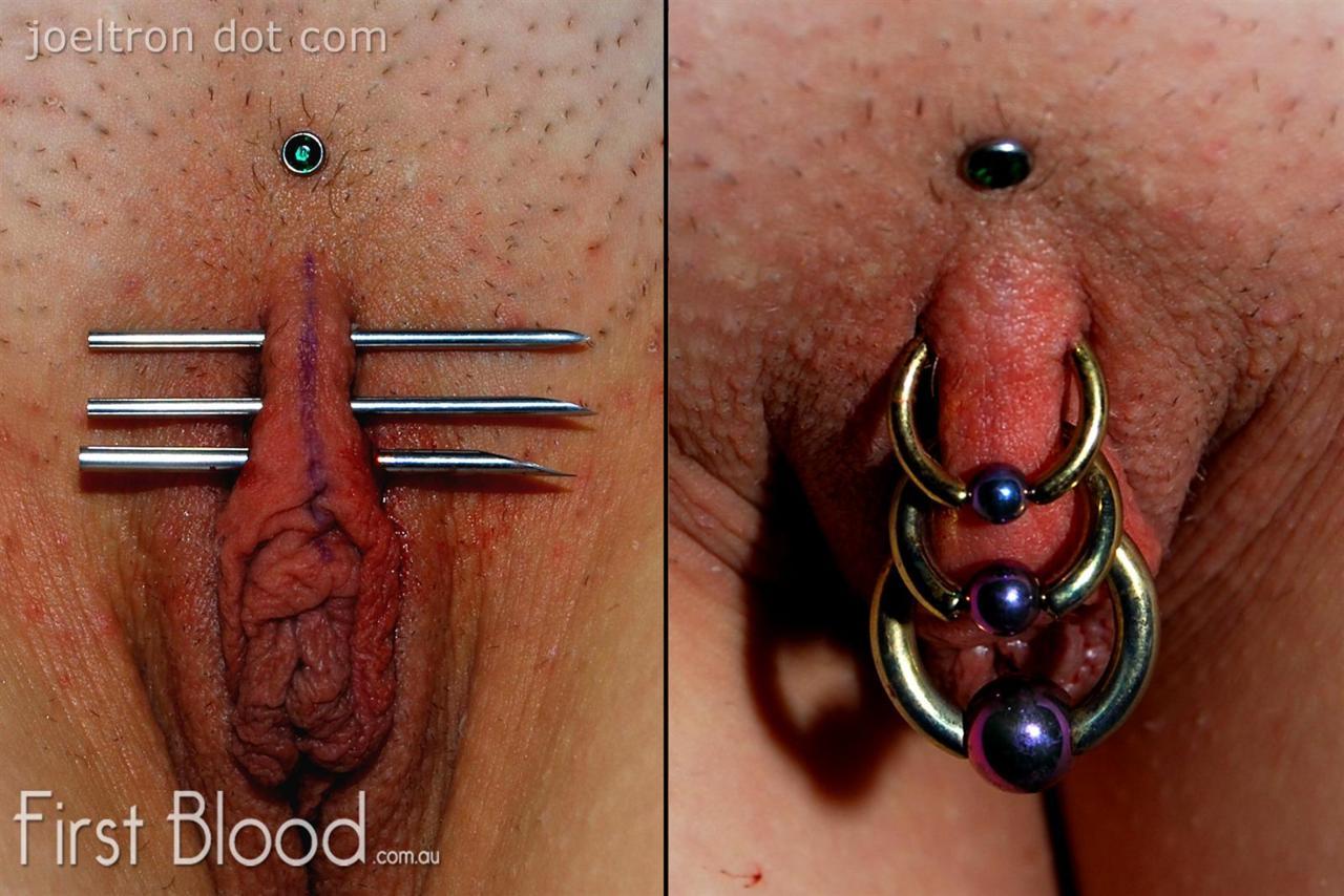 pussymodsgalore  On the left the piercing needles are through, clit hood marked with