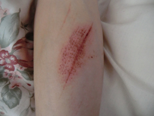 reclusivesouls:  ☹ sad ☹