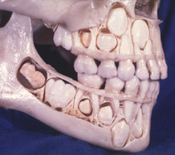 thatsnotwatyourmomsaid:  allisonelisabeta:  a child’s skull before losing baby teeth.  CHILDREN ARE FREAKS 