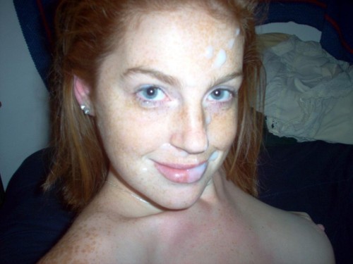 slicklyglazed: In all honesty, I’m not a fan of a lot of freckles. Fortunately, there’s 