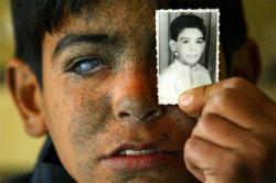 brbkillingnubs:  Iraqi boy, Ayad Brissam Karim, shows a picture of himself taken before his “accident.” US helicopters attacked the vegetable field where he played, leaving him blind and with burns to his face…He was “liberated” 