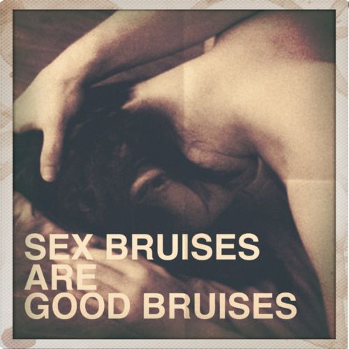 No they’re not. They’re GREAT bruises. Only like that is my Fuckslave happy.