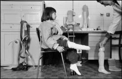 fotojournalismus:  Sarajevo, 1993. Nine year old Samra Grapho had a foot amputated in July 1993, when a Serb mortar shell landed outside her house. For the first time she tries on an artificial leg at the Neretva Orthopedic Center. [Credit : Abbas] 