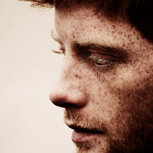 yardmarc:  Orange Freckles  