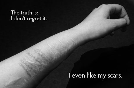 I find hope in pain.