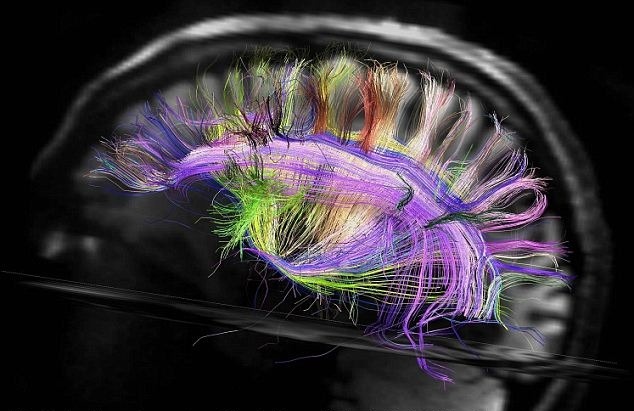 notalwaysred:  Harvard scientists map the inside of the human brain as a magnetic