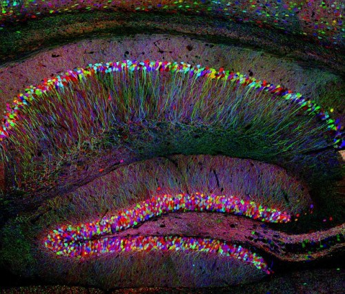 thekiereneffect: pizzazzer: notalwaysred: Harvard scientists map the inside of the human brain as a 