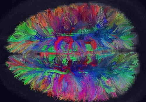 thekiereneffect: pizzazzer: notalwaysred: Harvard scientists map the inside of the human brain as a 