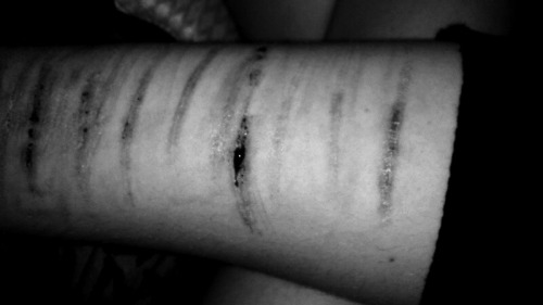 ihavenotmadeitthisfartostopnow:  My arm 