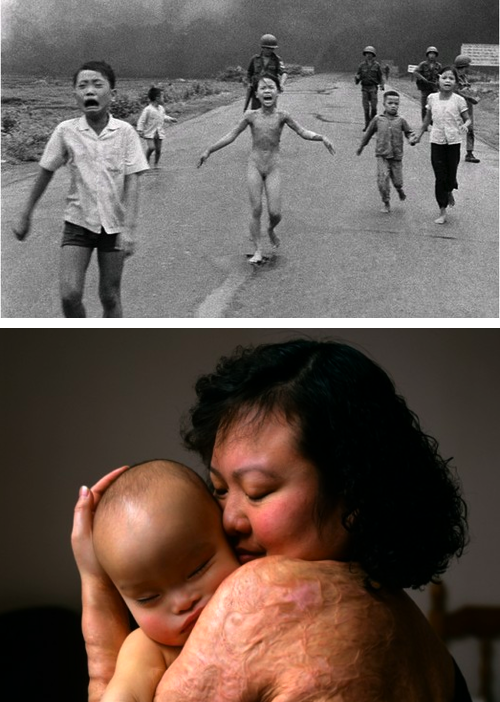 The ‘Napalm Girl’, 40 years later     Joe McNally, who was commissioned by LIFE magazine to find and photograph subjects of Pulitzer Prize winning photos, shot Kim Phuc – the girl running from an airborne attack in this devastatingly iconic shot during