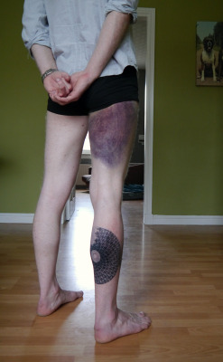 theshroudedstranger:  My bruise from Muay