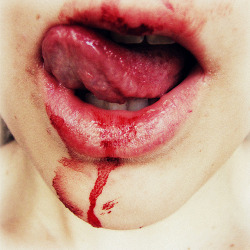 felipeisaza:  blood, ick, lips, smile, teeth