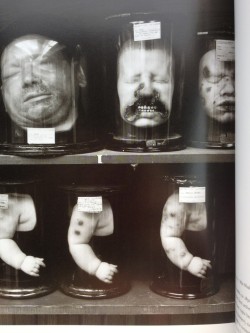 odditiesoflife:  Another photograph from the Mutter Museum in Philadelphia, PA.  Heads and baby arms.