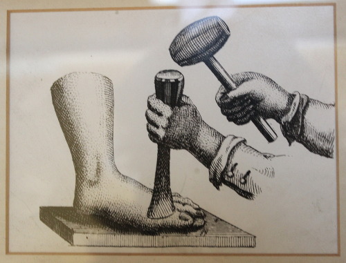 prosthodontia: Amputation of the hallux (generally referred to as “the big toe”), 1745.&