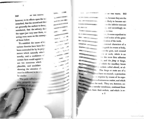 Page-turning.
From p. 240-243 (?) of A View of the Structure, Functions, and Disorders of the Stomach and Alimentary Organs of the Human Body by Thomas Hare (1821). Original from Harvard University. Digitized January 27, 2006.