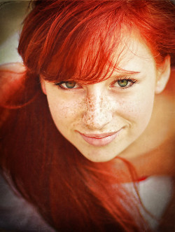 Freckles!! :)