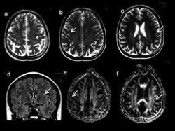 serial-killers-101:  List of Paraphilias