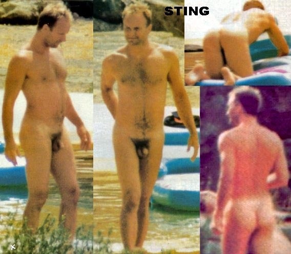 Sting