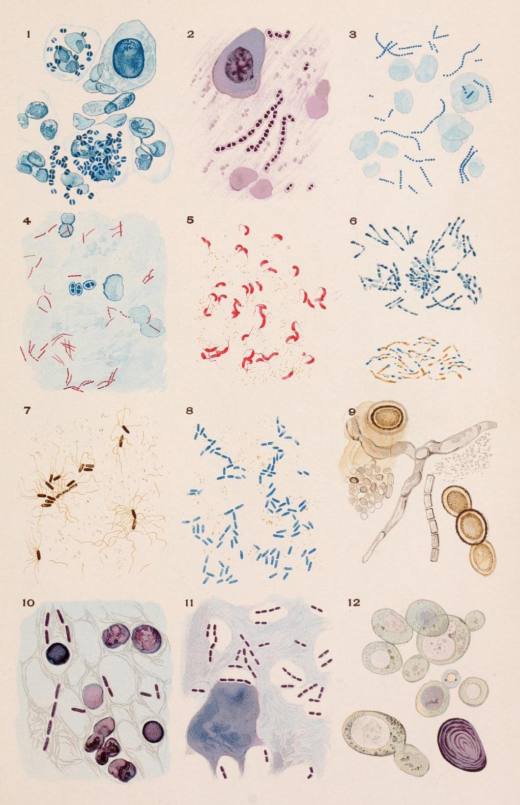 Bacteriologic Chart
• Gonococcus spp.
• Pneumococcus spp.
• Streptococcus pyogenes
• Micobacterium tuberculosis
• Vibrio cholerae
• Corynebacterium diphtheriae
• Bacterium typhosum
• Bacterium dysenteriae
• Achorion Schonleinii [favus fungus]
•...