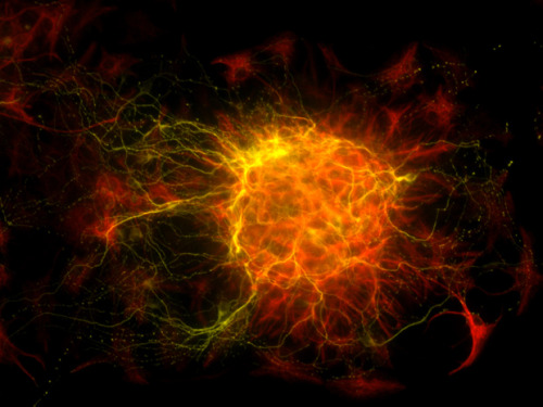 The Birth of Brain CellsThis might look like a distant web of galaxies captured by a powerful telesc