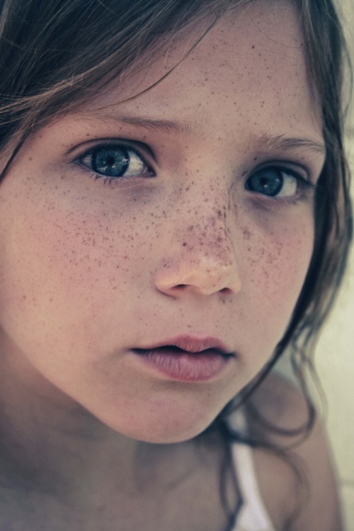 houin: Freckle Face.XxX by ~Pretty-As-A-Picture And still I can’t see how she despises them so