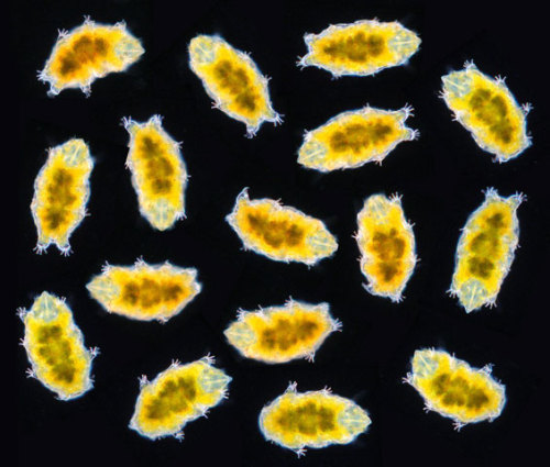 frontal-cortex: Echiniscus mediantus (tardigrade, water bear), in various states of movement Techniq