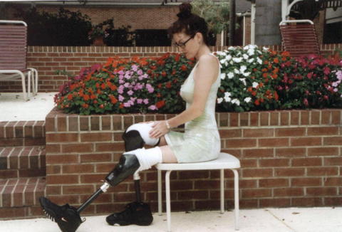 autlib:  Some more pictures of ”Chelsea” with her prostheses on (2/2). Thanks to gentle 