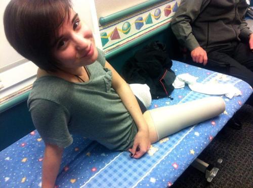 Anna Beninati who went train jumping and lost her legs. See also Kristen Jane Anderson (suicide atte