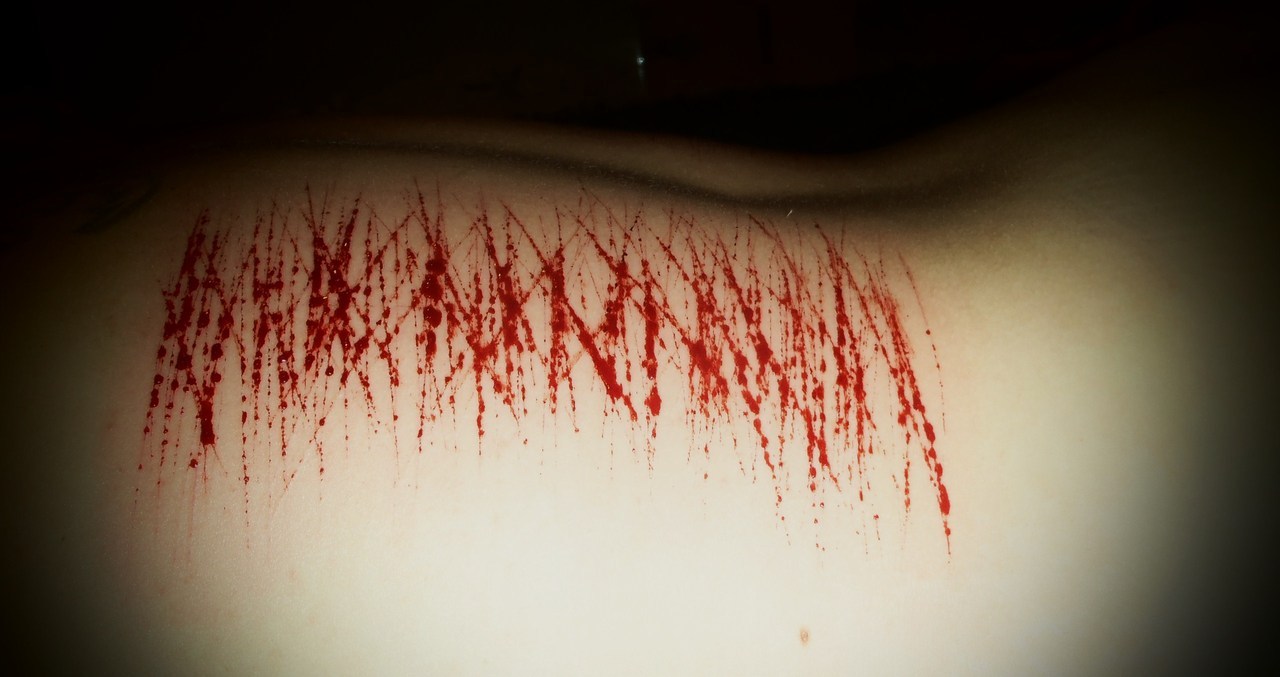 sexcapadesofakinkylesbian:  The amazing blood play we did on the last night of our